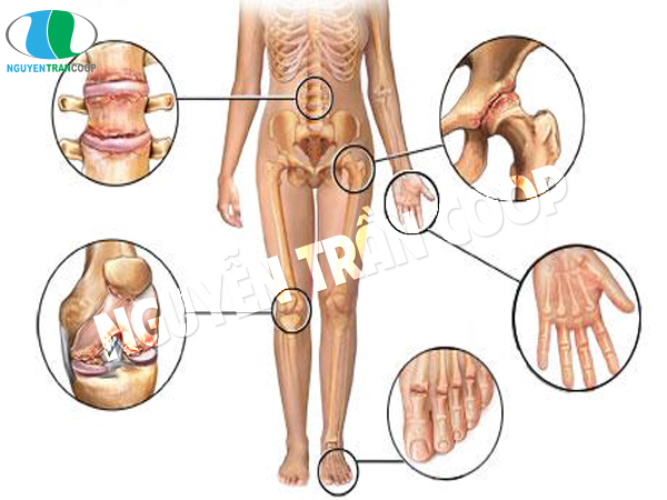 Thuốc Bổ Xương Khớp Schiff Glucosamine 2000 mg