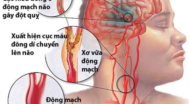 Tác dụng phụ an cung ngưu hoàng