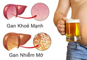 gan nhiem mo