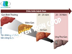 Cách sử dụng Cây An Xoa chữa bệnh gan hiệu quả