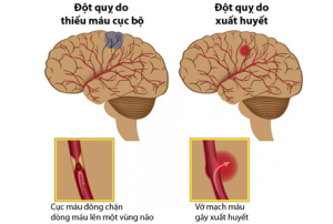 dot quy do thieu mau