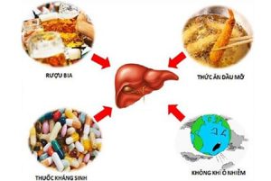 Nguyên Nhân Gây Nóng Gan?