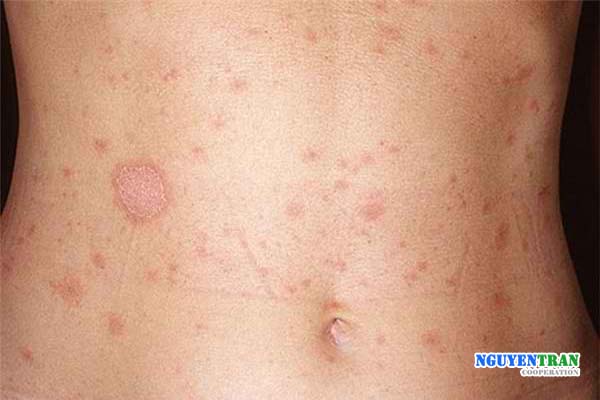 Lá đu đủ ngăn ngừa lão hóa