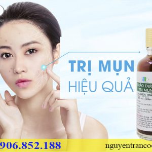thảo dược trị mụn nguyễn trần