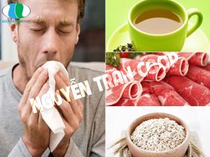 Bệnh ung thư phổi nên ăn gì? Chế độ ăn cho người ung thư phổi?