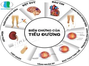 Ít người biết cách dùng Nấm Lim Xanh chữa tiểu đường