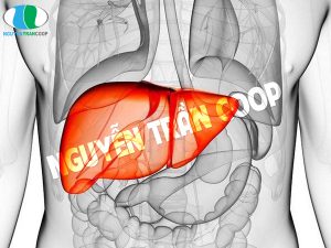 Cách chữa nóng gan tại nhà thật đơn giản mà bạn nên biết