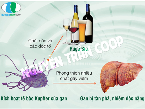 Dùng Cây An Xoa bảo vệ gan cho người uống nhiều bia rượu