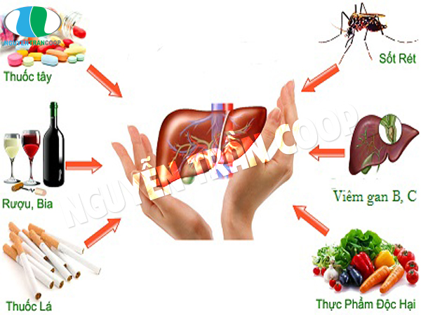 Phương pháp điều trị xơ gan giai đoạn đầu là như thế nào?