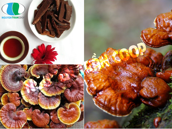 Rối loạn tuần hoàn não có nguy hiểm không?