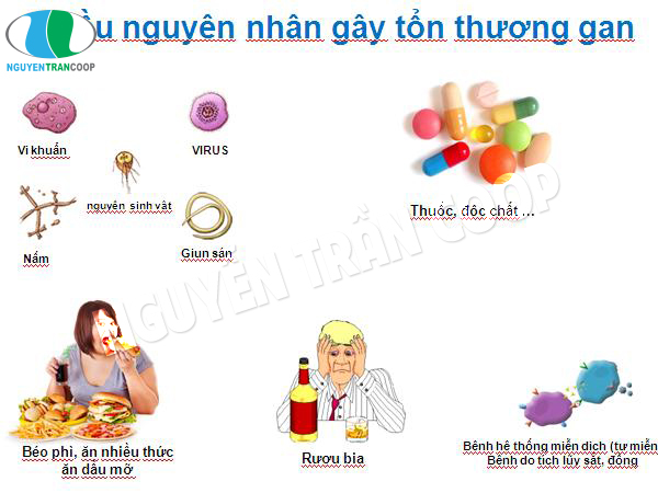 Bệnh gan là gì? Mắc bệnh gan có còn cơ hội cứu chữa được không?