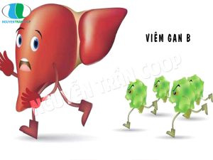 Bệnh viêm gan B là gì? Vì sao cần ngăn chặn bệnh từ sớm?