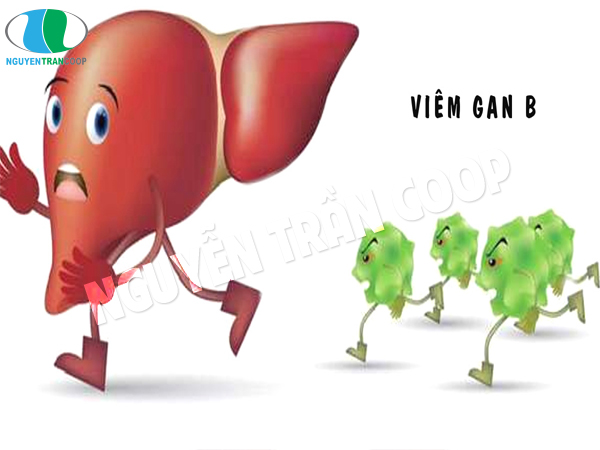 Bệnh viêm gan B là gì? Vì sao cần ngăn chặn bệnh từ sớm?