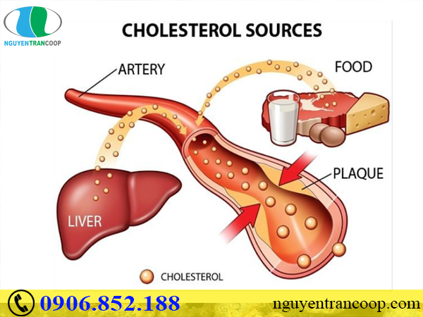 Cẩm nang vàng giúp bạn giảm cholesterol trong máu hiệu quả