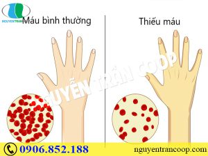Hãy tăng cân nếu muốn tránh tác hại khi quá gầy yếu