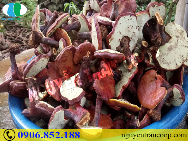 Khốn khổ tìm cách chữa đau nhức xương khớp mùa lạnh