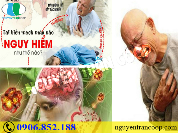 Người lớn tuổi cần chú ý giảm nguy cơ tai biến vào mùa lạnh