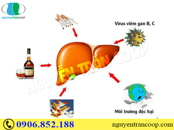 Những tác nhân gây hại cho gan hàng đầu hiện nay