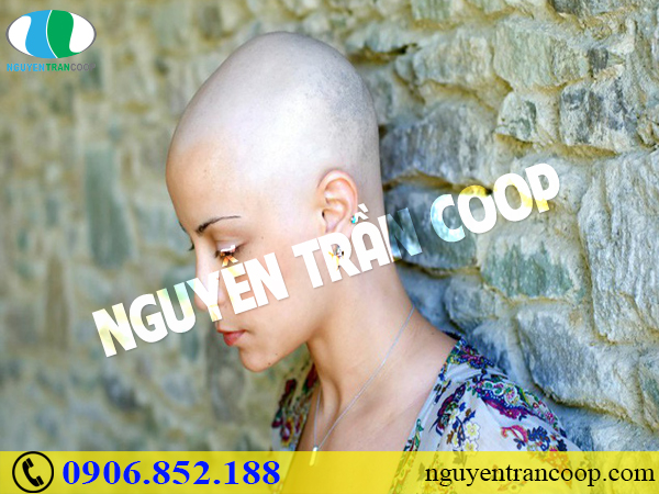 Phải làm thế nào khi bị rụng tóc sau hóa trị?