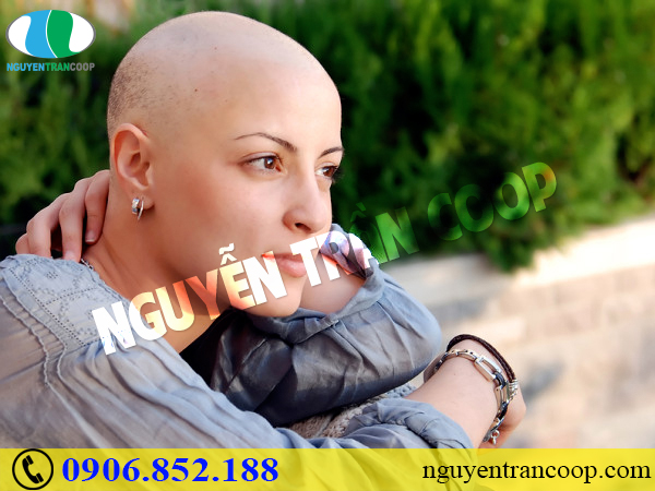 Phải làm thế nào khi bị rụng tóc sau hóa trị?