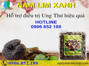 Thực phẩm nhiều cholesterol - Thật tai hại cho tim mạch!