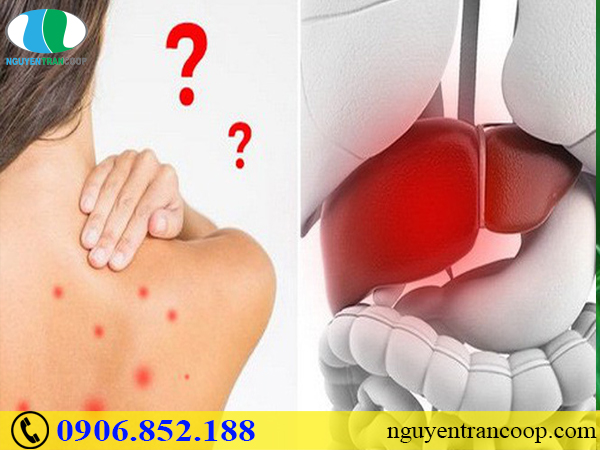 Triệu chứng suy giảm chức năng gan có dễ nhận biết?