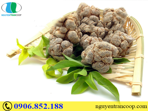 Xơ vữa động mạch - Căn bệnh âm thầm không thể coi thường