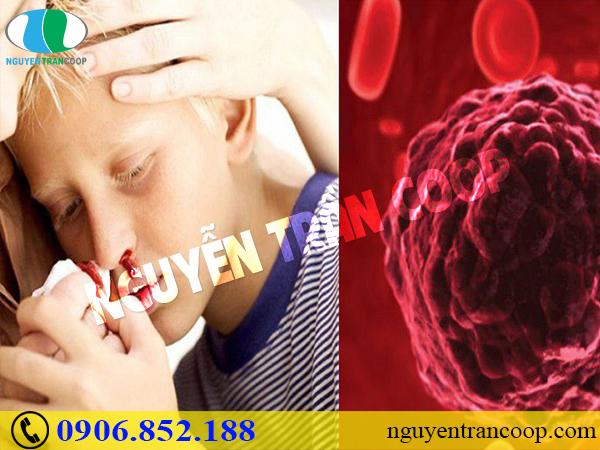 Bài thuốc Tam Thất Bắc và bệnh ung thư máu