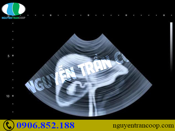 Bạn có nằm trong nhóm người dễ mắc ung thư gan hay không?