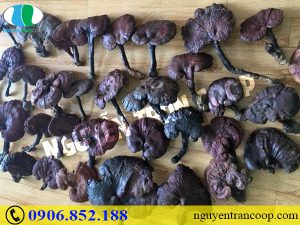 Bệnh cao huyết áp cần kiêng gì - Người bệnh nên biết