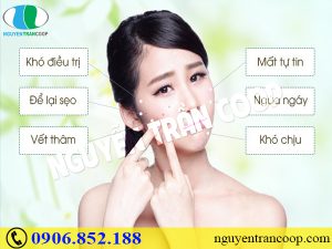 Các cách trị mụn tuổi dậy thì và ngăn mụn tái phát