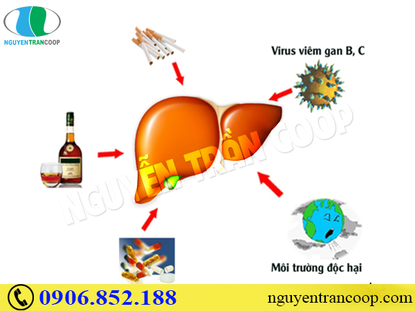 Ngạc nhiên vì những nguồn lây nhiễm bệnh gan không ngờ đến