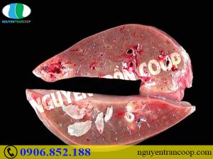 Nguyên nhân bị sán lá gan ai cũng dễ mắc phải