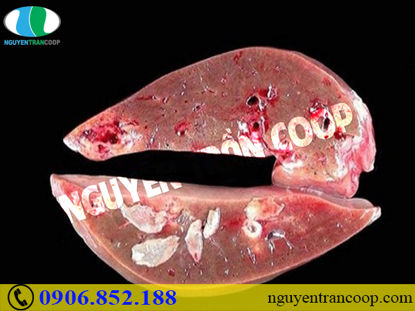 Nguyên nhân bị sán lá gan ai cũng dễ mắc phải