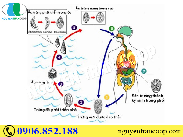 Nguyên nhân bị sán lá gan ai cũng dễ mắc phải
