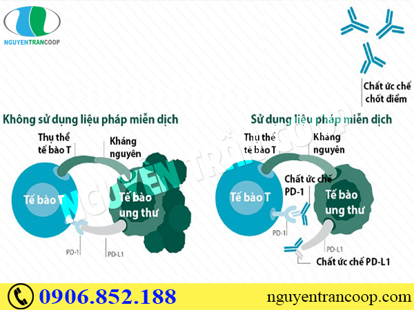 Những phương pháp chữa ung thư phổi hiệu quả nhất hiện nay