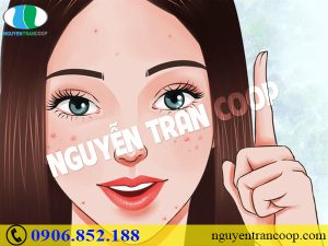 Những sai lầm khi trị mụn làm cho mụn vẫn cứ “ghé thăm” làn da