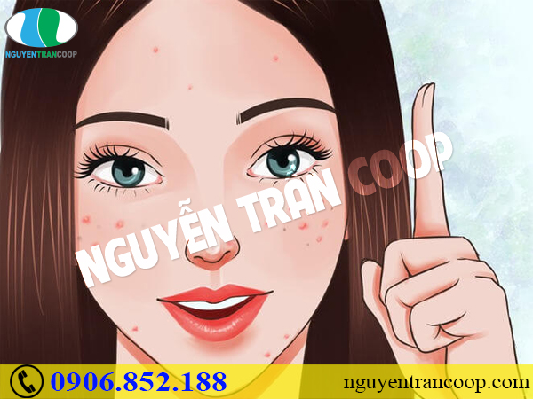 Những sai lầm khi trị mụn làm cho mụn vẫn cứ “ghé thăm” làn da