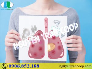 Những sự thật không phải ai cũng biết về bệnh ung thư phổi