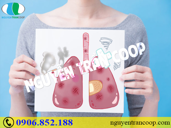 Những sự thật không phải ai cũng biết về bệnh ung thư phổi
