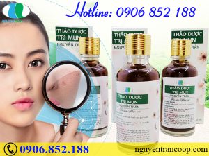 Thử ngay cách trị mụn từ thiên nhiên - Hiệu quả bất ngờ