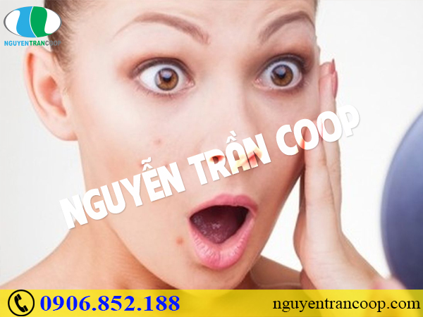 Tìm hiểu tận gốc nguyên nhân gây ra mụn (Phần 2)