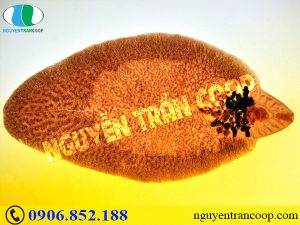 Triệu chứng của sán lá gan và cách điều trị