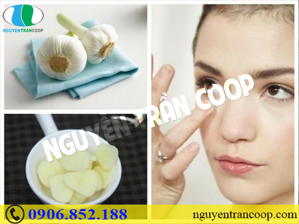 Bất ngờ với cách trị mụn nhanh nhất chỉ sau 1 ngày