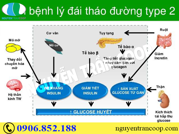 Bệnh tiểu đường tuýp 2 là gì mà ai cũng dễ mắc?