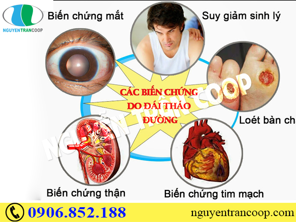 dang-so-voi-nhung-bien-chung-benh-tieu-duong