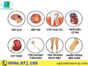 dang-so-voi-nhung-bien-chung-benh-tieu-duong