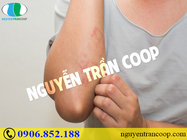Phát hiện sớm những triệu chứng bệnh tiểu đường