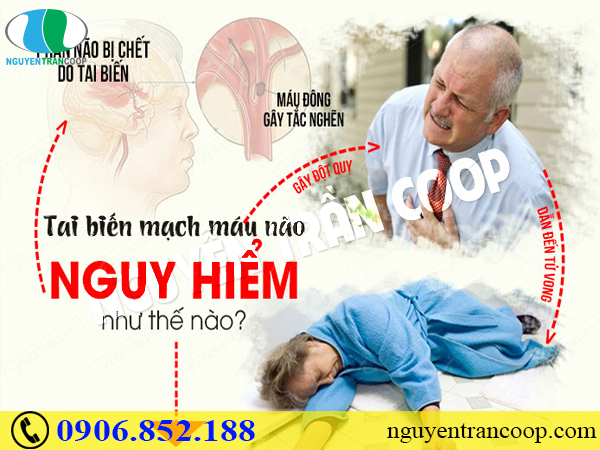 Phục hồi sau tai biến mạch máu não có khó không?