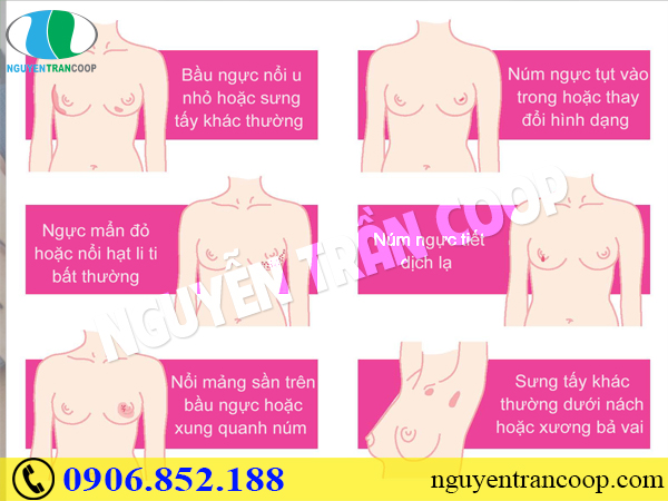 Thực hư Xáo Tam Phân chữa ung thư vú?